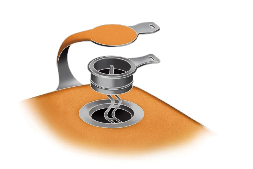 Hot Sale 🔥 NEMO Tensor Insulated Ultralight Sleeping Pad - Regular 🎁 10 NEMO Tensor Insulated Ultralight Sleeping Pad - Regular